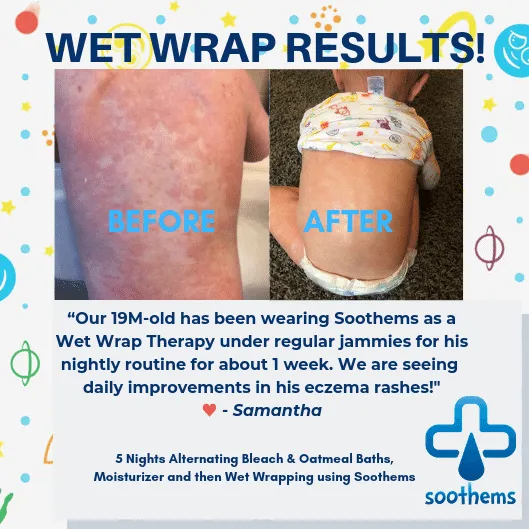 Soothems Kids' Eczema Pants – Wet Wrap & Sensitive Skin Relief