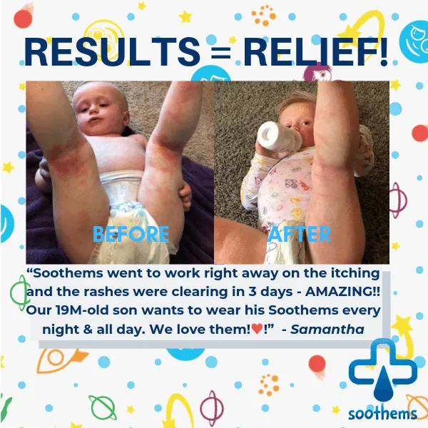 Soothems Kids' Eczema Pants – Wet Wrap & Sensitive Skin Relief